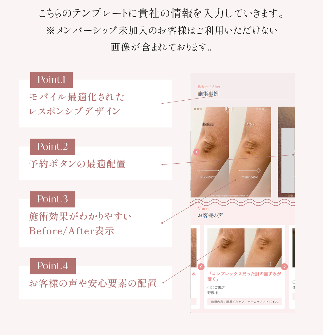  Point.1 モバイル最適化されたレスポンシブデザイン Point.2 予約ボタンの最適配置 Point.3 施術効果がわかりやすいBefore/After表示 Point.4 お客様の声や安心要素の配置