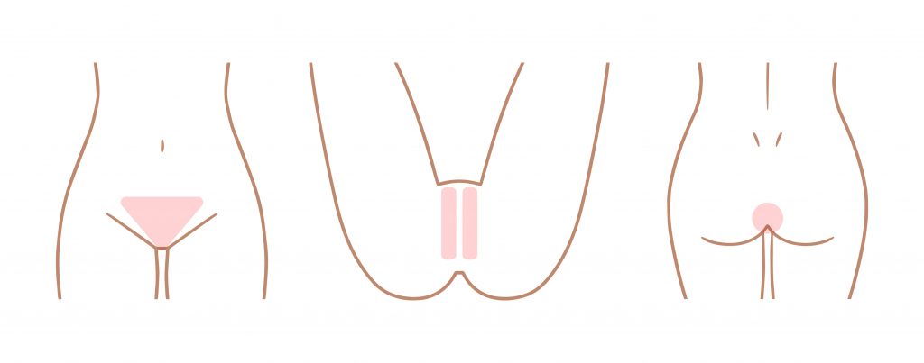 ルメラでデリケートゾーンの黒ずみを、皆さんが本来もっている赤ちゃんのころの肌色に戻しませんか？今回はデリケートゾーンの黒ずみの原因を細かくご説明させていただきます。