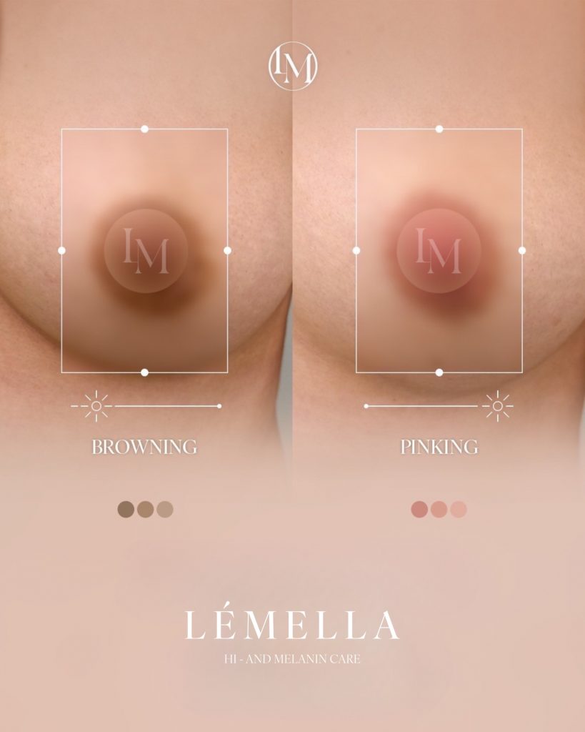 2025年10月版【ルメラの施術事例集:乳首(乳輪)】| 黒ずみ除去ルメラ 9 ルメラ 乳首 乳輪 ビフォーアフター写真