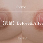 ルメラ乳輪・乳首BA写真