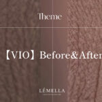 ルメラ VIOビフォーアフター