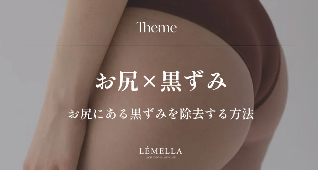 お尻の黒ずみが気になるけど、自己流ケアで悪化させたくない。正しいお尻の黒ずみ除去方法ってあるのかな？